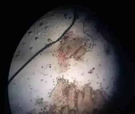 黄颡鱼苗遭遇寄生虫，用甲醛杀灭需药培水