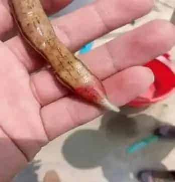 水蛭养殖过程中常见病水鼓病的防治方法