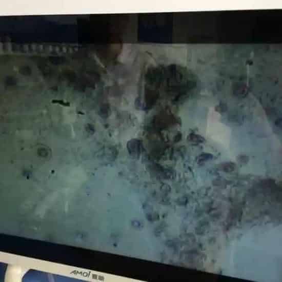 一个生鱼“烂头烂嘴病”成功处理案例分享