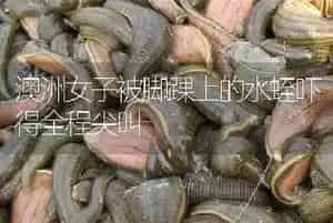 澳洲女子被脚踝上的水蛭吓得全程尖叫