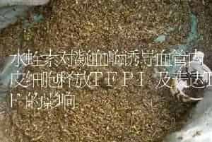 水蛭素对凝血酶诱导血管内皮细胞释放TFPI及表达TF的影响