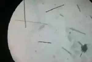 水产养殖户如何正确的看待蓝藻?